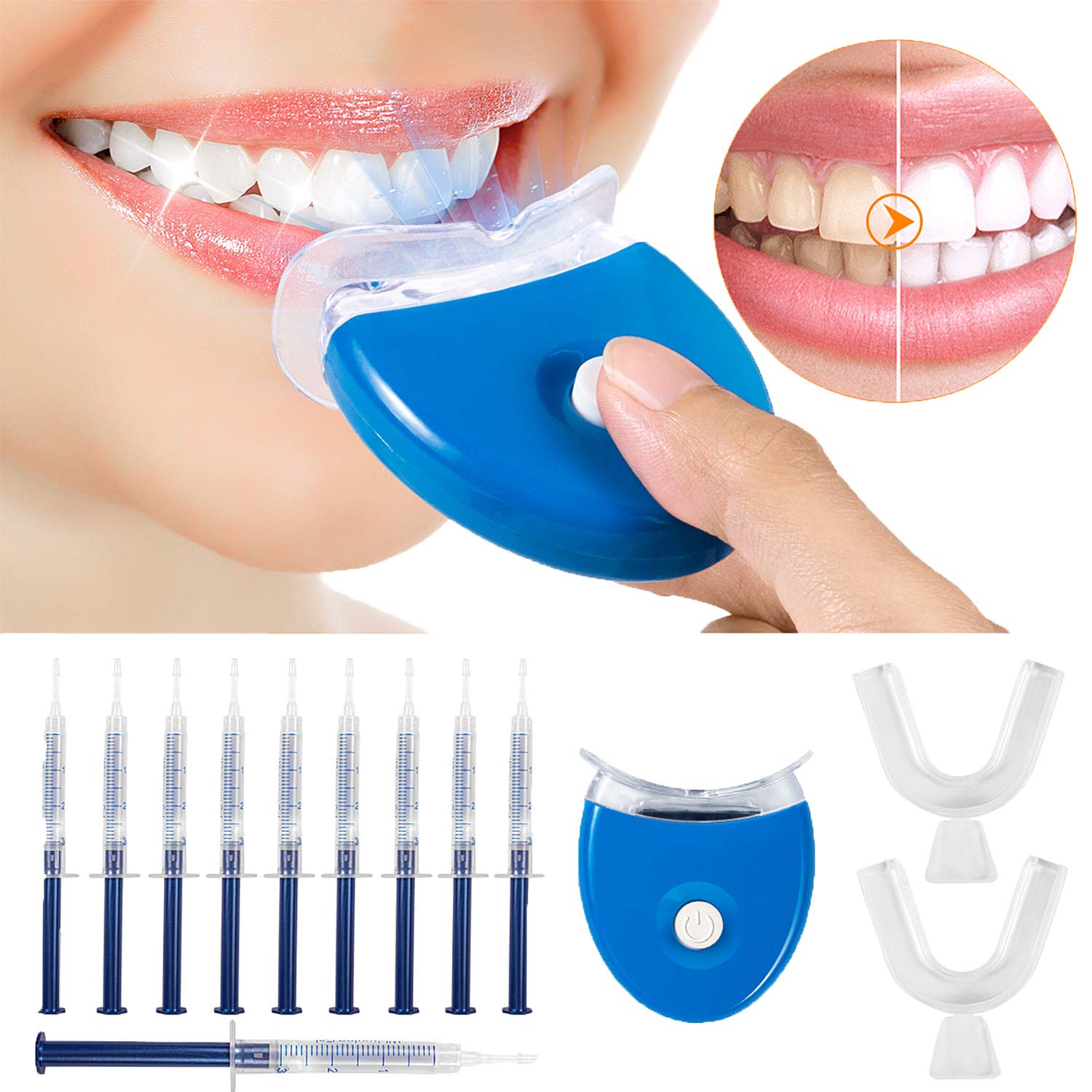 3. Teeth Whitening Kits.jpg
